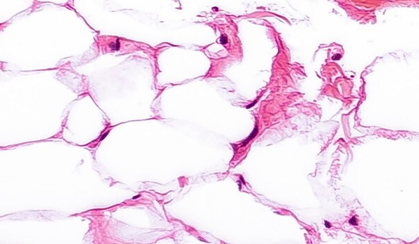 Curso de Tejido Adiposo Como un Órgano Endocrinológicamente Activo