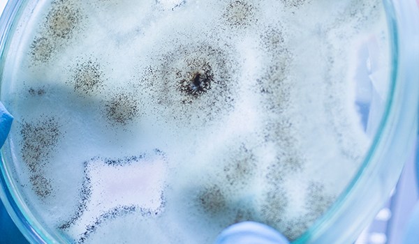 Curso de Enfermedades Infecciosas Causadas por Hongos