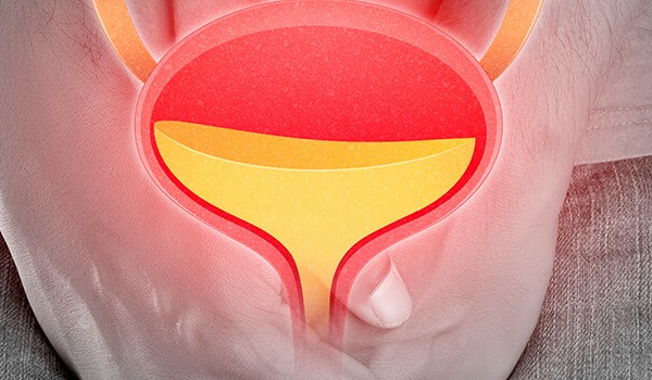 Curso de Incontinencia Urinaria: Generalidades para Fisioterapeutas