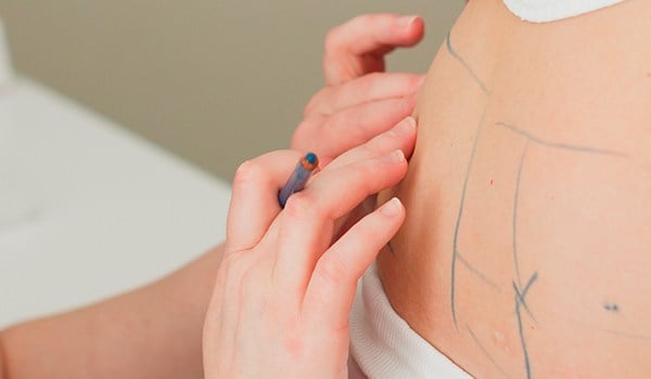 Curso de Cuidados e Intervención Profesional en la Cirugía de la Obesidad