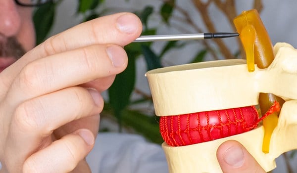 Curso de Enfermedades Autoinmunes Neurológicas