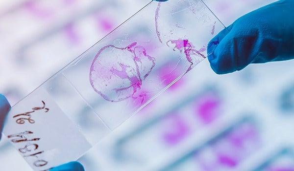 Curso de Enfermedades Infecciosas. Recogida de Muestras