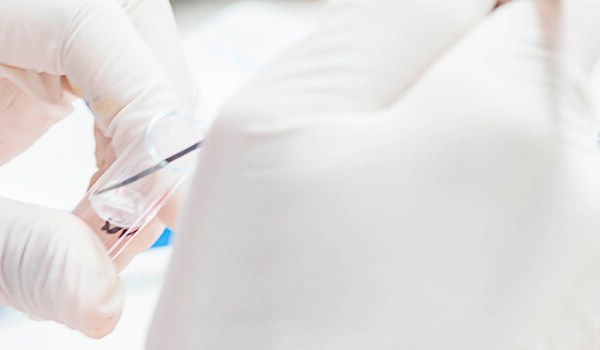 Curso Universitario en Actualización en Enfermedades Infecciosas y Microbiología Clínica