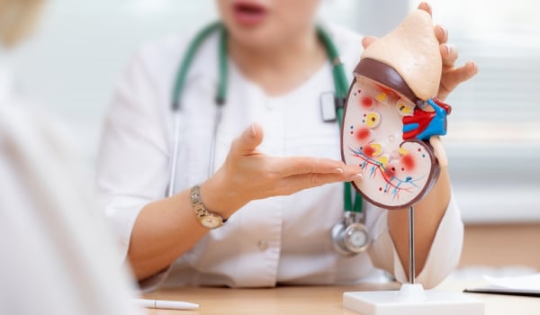 Experto Universitario en Nefrología, Diálisis y Trasplante