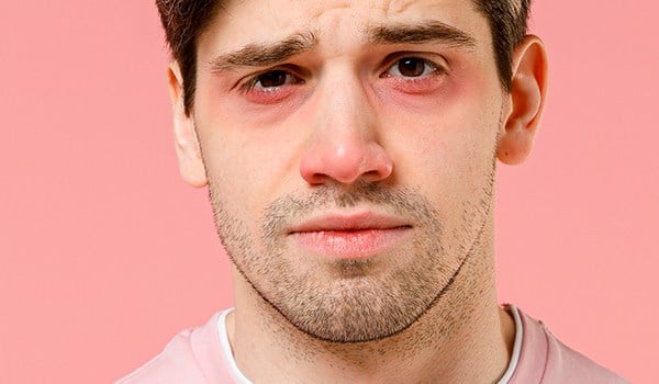 Curso Superior Universitario en Alergología en Atención Primaria