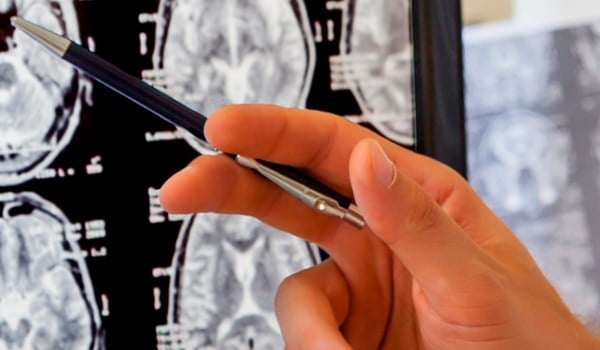 Curso Superior Universitario en Imagenología