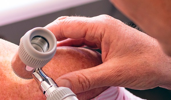 Curso Superior Universitario en Dermatología Geriátrica