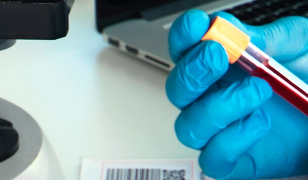 Experto Universitario en Laboratorio Clínico para Técnico Superior de Laboratorio Clínico y Biomédico