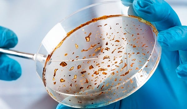 Curso Universitario en Avances en Identificación de Bacterias y Hongos en Microbiología Clínica