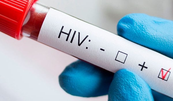 Experto Universitario en Enfermedades de Transmisión Sexual y VIH