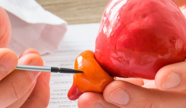 Curso Universitario en Tratamiento del Cáncer de Próstata Localizado