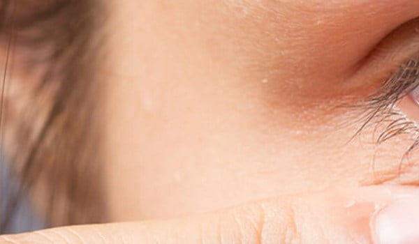 Curso Universitario en Tumores Oftalmológicos. Actualización Diagnóstica y Terapéutica