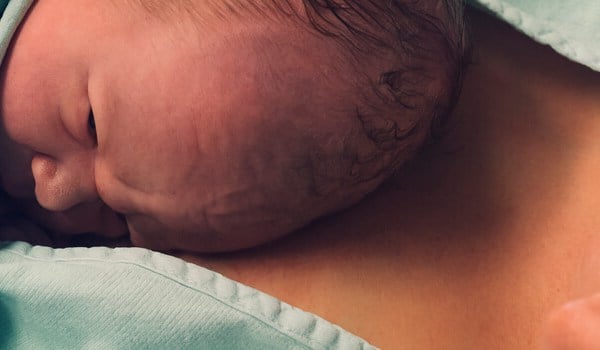 Curso Universitario en Contacto Piel con Piel Precoz en el Recién Nacido