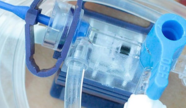 Curso de Acceso Arterial Periférico Ecoguiado en Reanimación y Cuidados Intensivos