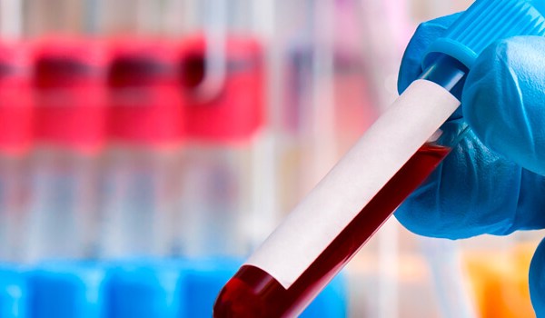 Curso de Atención y Cuidados en Patologías Infecciosas