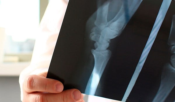 Curso de Cuidados de Enfermería en Traumatología