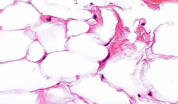 Curso de Tejido Adiposo Como un Órgano Endocrinológicamente Activo