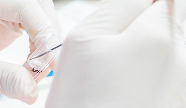 Curso Universitario en Actualización en Enfermedades Infecciosas y Microbiología Clínica