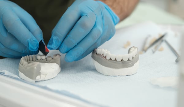 Curso Universitario en Estética Dental con Carillas: Planificación, Técnicas Clínicas y Manejo Estético Avanzado