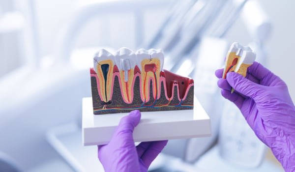 Curso Universitario en Endodoncia Clínica Integral: Tratamiento Convencional, Cirugía y Tecnologías Avanzadas