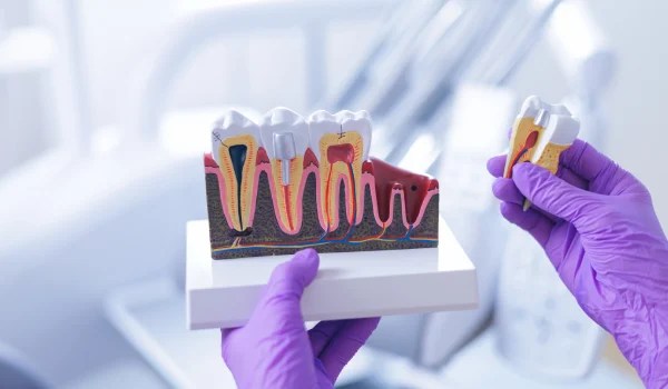 Curso Universitario en Endodoncia Clínica Integral: Tratamiento Convencional, Cirugía y Tecnologías Avanzadas