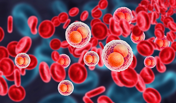 Curso Universitario en Hemoterapia
