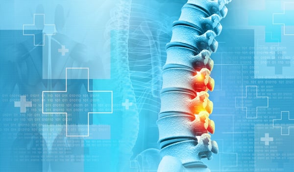 Curso Universitario Superior en Lesión Medular: Atención Sanitaria
