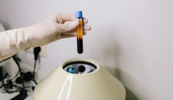 Curso Universitario en Tratamiento con Plasma Rico en Plaquetas