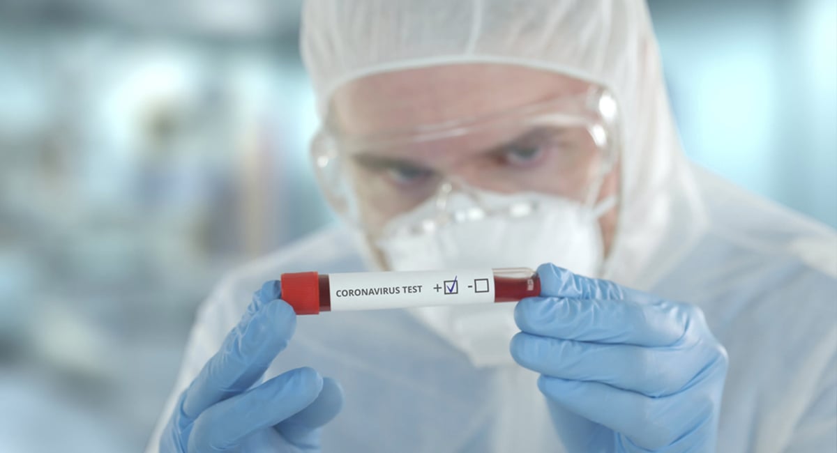 Actualización y prevención de la infección por coronavirus