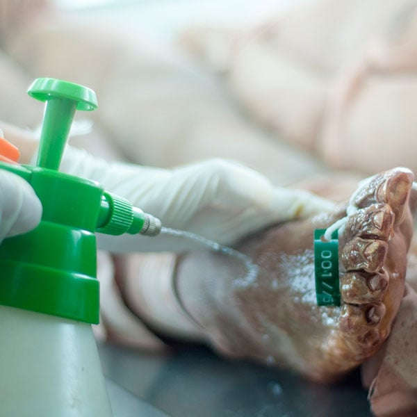 Conservación transitoria y embalsamamiento de cadáveres con productos biocidas