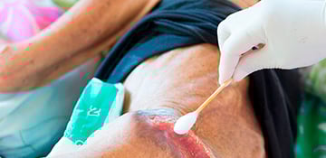 Curso Gratis de Evaluación y Clasificación de Heridas: Abordajes Diagnósticos y Tratamientos