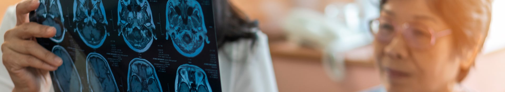Curso Gratis de Intervención Cognitiva y Áreas Afectadas en el Alzheimer