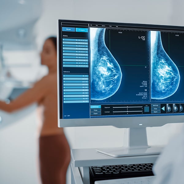 Experto Universitario de Posgrado en Actualización en Patología Mamaria y Cáncer de Mama