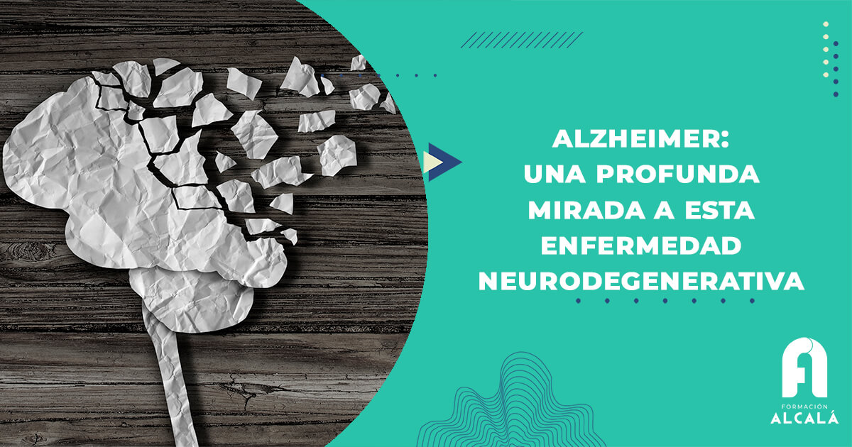 Imagen de Alzheimer: Una profunda mirada a esta enfermedad neurodegenerativa