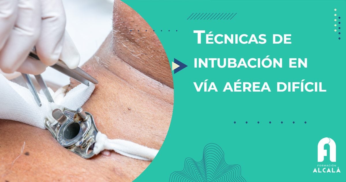 Imagen de Guía de intubación en vía aérea difícil: de la laringoscopia tradicional a la videolaringoscopia